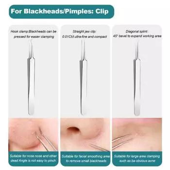 1 шт./3 шт./5 шт./8 шт. ультратонкая игла от прыщей, точный инструмент для удаления угрей, антикоррозийная игла от прыщей из нержавеющей стали