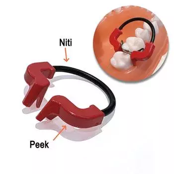 1 шт. или 2 шт. или 3 шт. Стоматологические контурные матрицы Кольцевое зажимное устройство с матричной системой PEEK Набор матриц Клиновые гибкие материалы NITI 1 piece blue