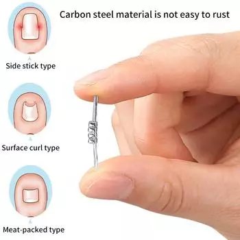 1 шт., инструмент для коррекции вросшего ногтя, невидимый вросший палец, эластичный зажим для выпрямления ногтей, инструмент для педикюра
