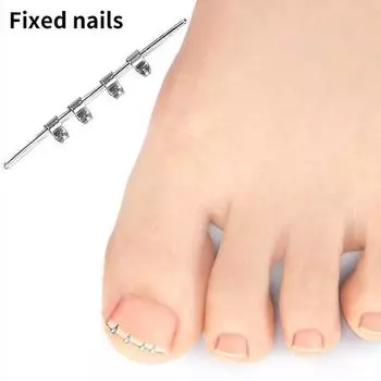 1 шт., инструмент для коррекции вросшего ногтя, невидимый вросший палец, эластичный зажим для выпрямления ногтей, инструмент для педикюра