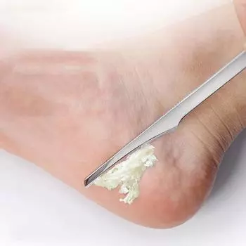 1 шт., инструменты для маникюра и педикюра, бритва для ногтей, набор ножей для педикюра, набор ножей для мозолей, пилочка для удаления омертвевшей кожи, инструменты для ухода за ногами