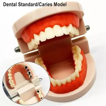 1 шт., модель зубного зуба, стандартная модель зубов, модель кариеса для общения с пациентом, модель для исследования стоматолога с разрушенным зубом 1 piece Standard Model