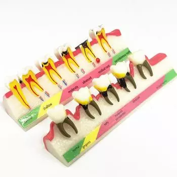 1 шт., модель зубов, заболевания пародонта, классификационная модель зубов Typodont, модель для обучения стоматологии 1 piece A