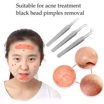 1 шт., пинцет для удаления черных точек и пятен, точечный изгиб, головка, экстрактор комедона, акне, инструменты для ухода за кожей лица 1