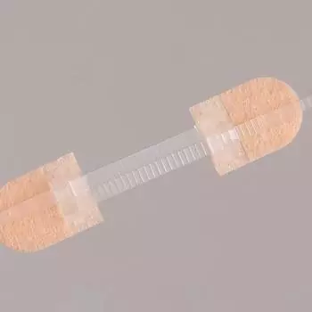 1 шт., пластырь для закрытия раны с застежкой-молнией, гемостатический пластырь для быстрого наложения швов на рану, переносной, для улицы