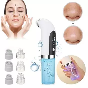 1 шт. пылесос для удаления черных точек, электрический очиститель пор, удаление черных точек, перезаряжаемый водный цикл, инструмент для чистки лица белый