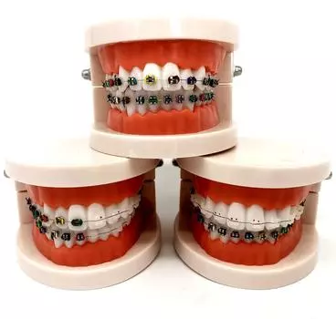 1 шт., стоматологическая модель для ухода за полостью рта, стоматологическая ортодонтическая модель для общения с пациентом, модель для исследования стоматолога 1 piece A