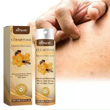 1 шт. Успокаивающий спрей для волосяных фолликулов, снимает кератоз, улучшает состояние волос и головы, продукт Blockag Y6X2 yellow-1pcs