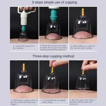 1 шт. Вакуумные банки для массажа, банки для китайской медицины, физиотерапия, антицеллюлитные присоски, массажер для тела, здоровый уход