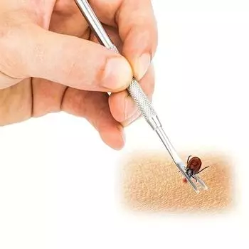 1шт нержавеющая сталь для обработки домашних животных набор инструментов для удаления клещей 2 в 1 вилка пинцет зажим принадлежности для кошек собак