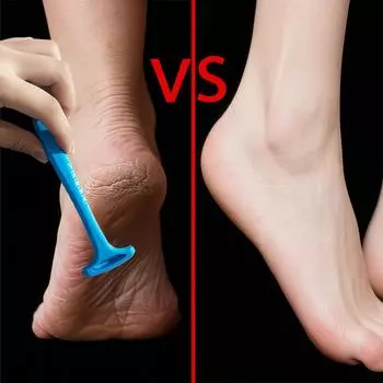 1шт. Скребок для ног, нож для ухода за ногами, инструмент для удаления омертвевшей кожи, пемза для удаления ног 1PC