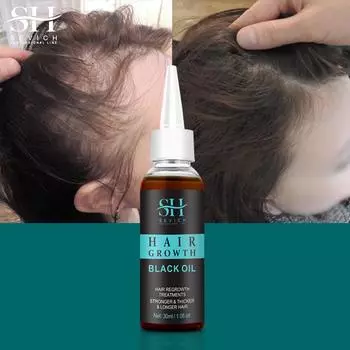 2023 Масло для роста волос при алопеции SevichМасло для быстрого роста волос для женщин и мужчин против выпадения волос, лечение истончения волос