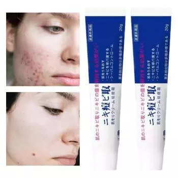 20 г крем от прыщей для лица японское увлажняющее средство быстрое впитывание уменьшает высыпания балансирует выработку кожного сала натуральный гель от прыщей 1pc