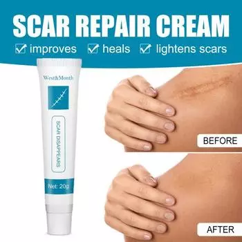 20 г мазь от прыщей, эффективный легкий удобный крем для удаления шрамов от прыщей и восстановления кожи 20g