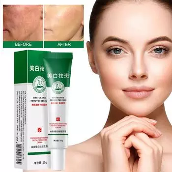20 г отбеливающий крем от веснушек для удаления темных пятен на лице крем от мелазмы осветляет пигментацию лыжи P9L3 white-20g