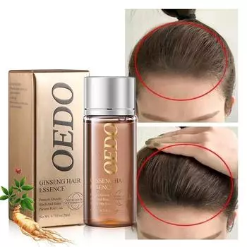 20 мл эфирного масла. Натуральное масло для роста волос. Стимулирует рост волос и предотвращает их выпадение. 20ml