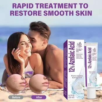 20 мл азелаиновой кислоты для удаления, закрытия, черных точек, акне и увлажнения