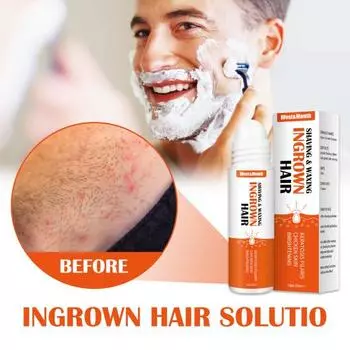 20 мл средство для лечения раздражений от бритвы, уменьшения покраснений, компактные растительные экстракты, бритье, восковая депиляция, вросшие волосы, жидкость для мужчин 20ml