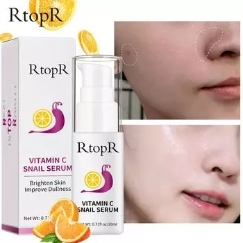 20 мл сыворотка с улиткой с витамином C, омоложение, укрепляющая, против морщин, яркая сыворотка для кожи для лица, лечение, сыворотка для восстановления коллагена с улиткой VC 20ml