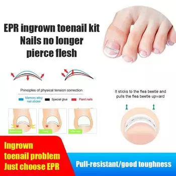 25/30 шт. 13-19 мм наклейки для коррекции ногтей корректирующие пластыри для вросшего ногтя лечение паронихии восстановительный уход инструменты для педикюра 17mm
