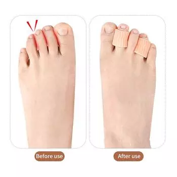 2 шт. силиконовый гель для защиты мизинца от мозолей и волдырей, корректор мизинца, гель для защиты косточки большого пальца ноги, защитный гелевый рукав телесный