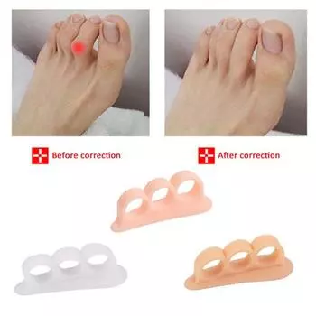 2 шт. силиконовый гель-молоток для выпрямления и корректора пальцев ног для скрюченных пальцев улучшает баланс, уменьшает дискомфорт белый