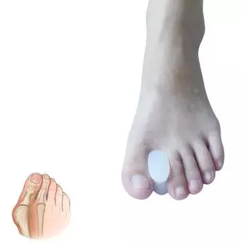 2 шт. силиконовый сепаратор, корректор бурсита ног, уход за ногами, облегчение боли, выпрямитель для пальцев ног