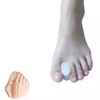 2 шт. силиконовый выпрямитель для пальцев ног, сепаратор, корректор бурсита, облегчение боли, уход за ногами