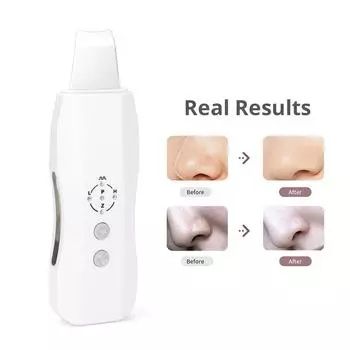 2 в 1 перезаряжаемый анионный ультразвуковой скруббер для омоложения кожи косметическое устройство 1 белый