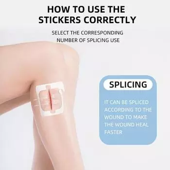 2 шт. пластырь для закрытия раны с застежкой-молнией, гемостатический пластырь для быстрого наложения швов на рану, переносной для использования на открытом воздухе M