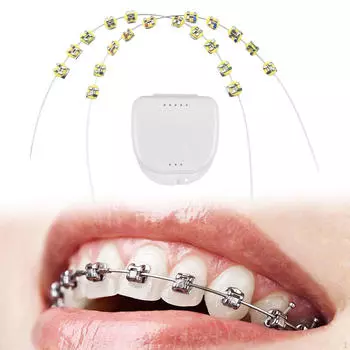 2x Временные украшения для зубов Брекеты Аксессуары Цепочки Лигатуры Yellow