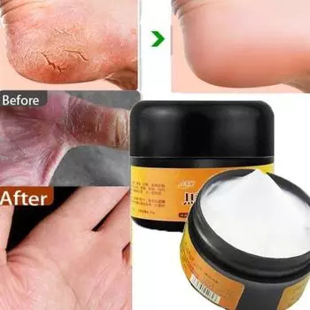 30 г легкий зуд ног, сухой крем от трещин на ногах, глубоко питающая мазь для ухода за кожей 30g