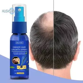 30 мл имбирное масло-спрей для роста волос для ухода за волосами, продукты для роста волос, выпадение волос 30ml