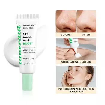 30 мл Эссенция с азелаиновой кислотой, лосьон от прыщей, угрей, черных точек, следов от прыщей, крем-эссенция 30ml