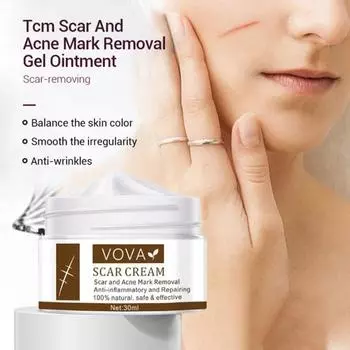 30 мл крем от шрамов быстро впитывающийся разглаживающий кожу натуральный экстракт удаление акне разглаживающий отбеливающий увлажняющий крем для женщин 30ML