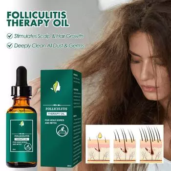 30 мл очищенное масло для ухода за волосами и кожей головы, глубокое очищение и восстановление кожи головы, очищенное масло для ухода за кожей головы One Size зелёный