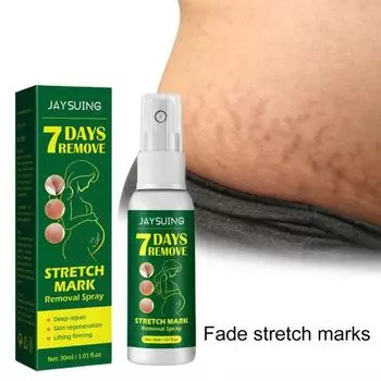 30 мл Универсальный быстро впитывающийся спрей для широкого применения, средство от растяжек для дома