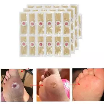 30 шт. подушечки для ног для удаления твердых мозолей. Немедленные результаты. Класс Удобные прочные материалы. Инновационные подушечки для удаления мозолей. Паста для удаления мозолей. 30Pcs Patch