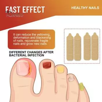 32/64/96 шт./упаковка пластыри для ухода за пальцами ног безопасные нежные средство от грибка ногтей улучшают внешний вид ногтей укрепляют ногти ночные пластыри от грибка ногтей 32 pcs жёлтый