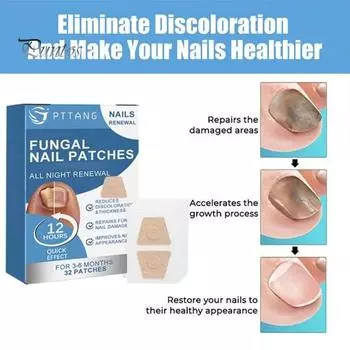 32 шт. пластыря для восстановления ногтей, пластырь для ног, мягкий, дышащий, утолщенный, не раздражающий средство для ногтей на ногах, для обесцвеченных, поврежденных ногтей 1 Set