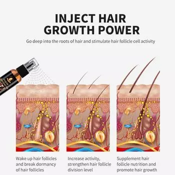 35 мл уход за волосами, мощный спрей для роста, питательное эфирное масло против выпадения волос, сыворотка для ухода за волосами против высыхания 35ML