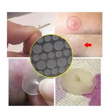 36/72/108 шт. наклейка для удаления прыщей против прыщей, пластырь для лечения угрей, пластырь от прыщей, маска для ухода за лицом, инструмент для ухода за кожей 36pcs