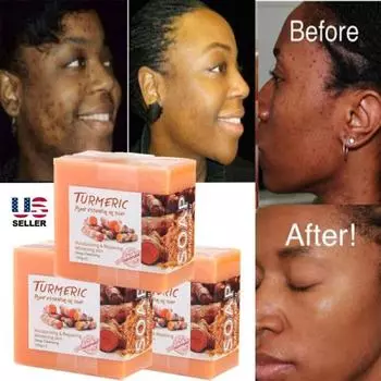 3 шт. Мыло с куркумой отбеливающее кожу темные пятна осветление акне осветление куркума M