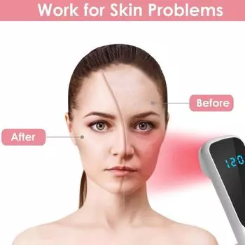 3 Вт Белый светодиод Красный Инфракрасный Светотерапевтический Прибор 850 нм 660 нм для Облегчения Боли