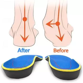 3D Orthotic insoles Flat feet Arch support Orthopedic inserts Plantar Fasciitis Feet Pain Pronation for Men Women Unisex S синий