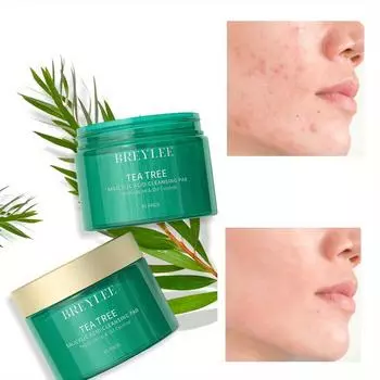 40 шт. очищающие ватные диски с салициловой кислотой глубоко очищают жиры на лице, улучшают увлажнение и увлажняют кожу 40pcs