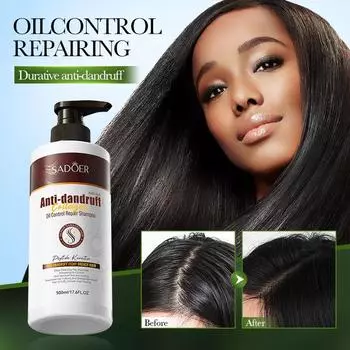 500 мл большой емкости коллагеновый шампунь против перхоти, регулирующий жирность, очищающий шампунь против перхоти 500ml