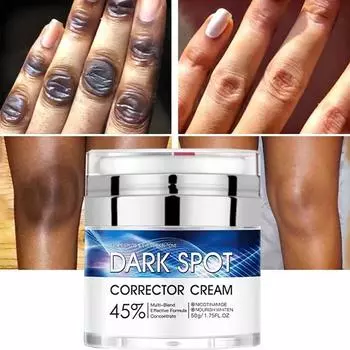 50 г крем для удаления темных пятен для лица, отбеливающий крем для неравномерного тона кожи, осветляющий крем для ухода за кожей, увлажняющий крем