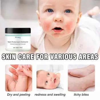 50 г крем для восстановления чувствительной кожи для детей, нежирная успокаивающая мазь от покраснений, увлажняющий крем для чувствительной кожи для сухих участков белый