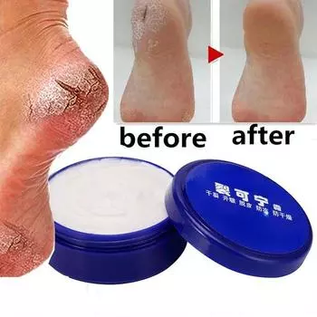 55 г масло против высыхания крем для ног от трещин крем для восстановления пяток и трещин крем для удаления омертвевшей кожи уход за руками и ногами маска для ног